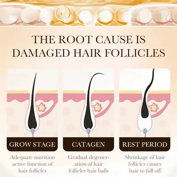 La croissance des cheveux, perte essentielle, traitement de repousse, renforce les cheveux, nourrit le cuir chevelu, léger, Non gras, améliore la Circulation du cuir chevelu