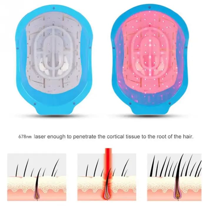 Casque de croissance de cheveux au Laser, 272 Diodes, longueur d'onde 678nm, thérapie capillaire Rechargeable par USB pour la repousse des cheveux et le traitement de la perte de cheveux