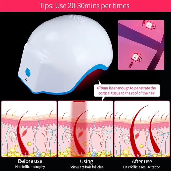 Casque de croissance de cheveux au Laser, 272 Diodes, longueur d'onde 678nm, thérapie capillaire Rechargeable par USB pour la repousse des cheveux et le traitement de la perte de cheveux